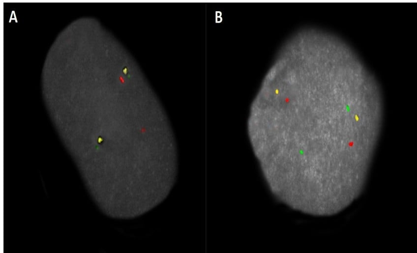 Interphase Chromosome Profiling 