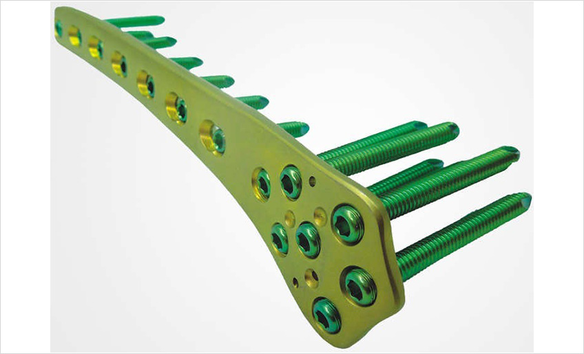 Orthopedic Implants 