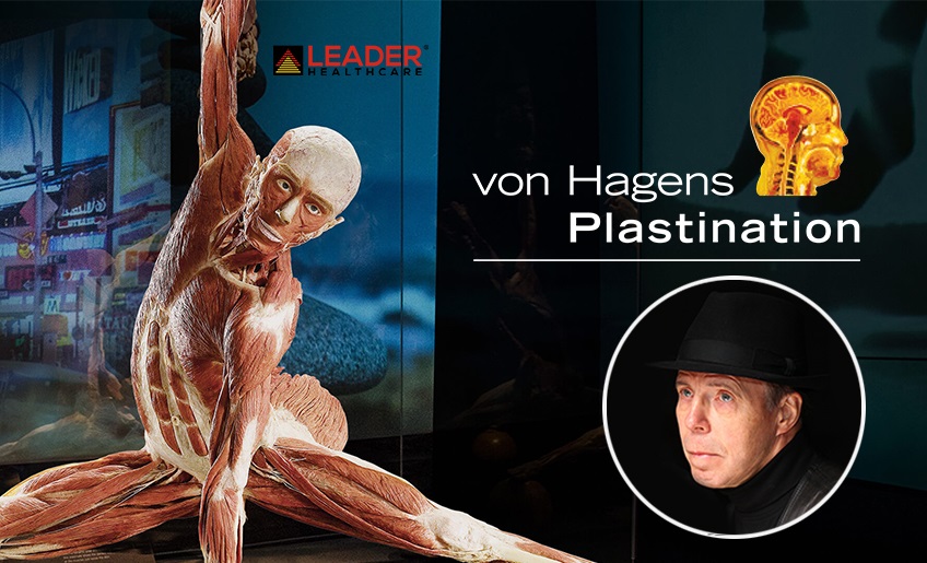 Von Hagens Plastination