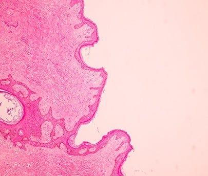 Emerging Trends in Mammography