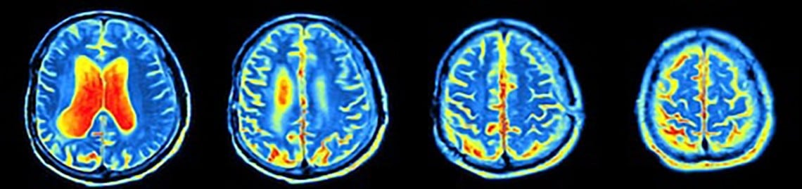 Risk Communication in Medical Imaging