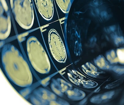 New Concepts in Oncologic Imaging